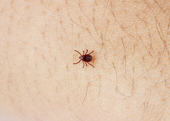 Tick crawling on human skin