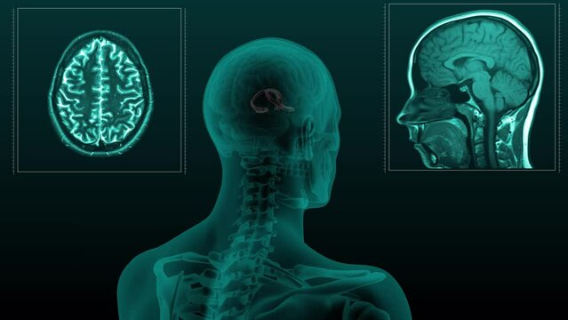 Magnetic Resonance Imaging, 3d render, brain, fornix cerebri, Brain stem, MRI, animation, hologram, render, dark, roentgen, cranium, physical, neurosurgery, 3d, radiological, blue, spinal, man, diagno