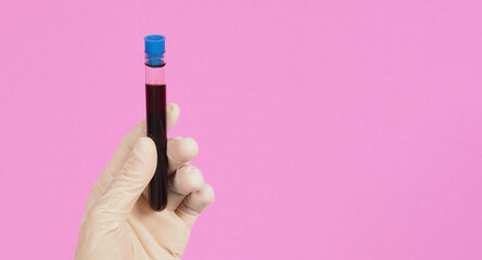 The hand is holding blood test tubes on pink background. Hand wears a white latex glove..