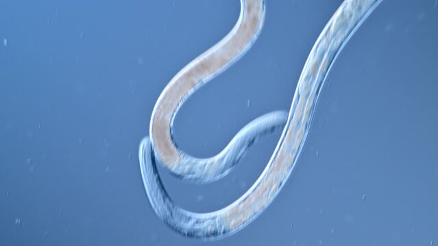 Nematodes in Vinegar ample under the microscope