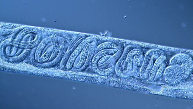 Close up of Vinegar eel nematode mother worm revealing different developmental stages of worm embryos 