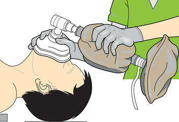 vector illustration of artificial ventilation bag and masks ambu