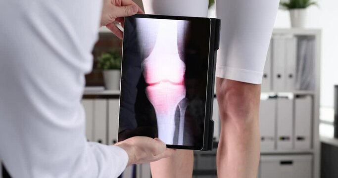 Doctor traumatologist scanning woman sore knee using digital tablet in clinic 4k movie slow motion. Diagnosis and treatment of rheumatoid arthritis concept