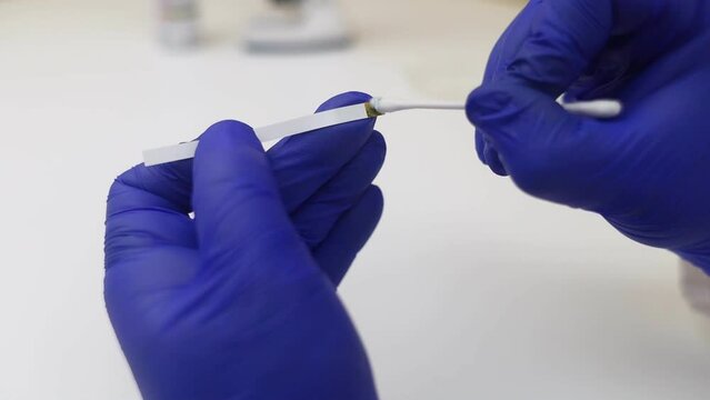 Bacterial Vaginosis. Vaginal pH. Diagnostic. Scale by which you can measure whether acidity normal or not. Normal acidity level shown in colors and must be compared with standard. Laboratory and home