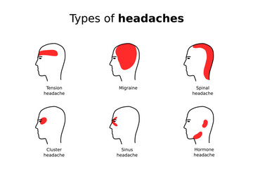 Types of headaches vector infographic