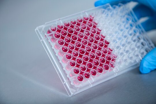 Closeup of a plastic container with liquid medicine in a lab