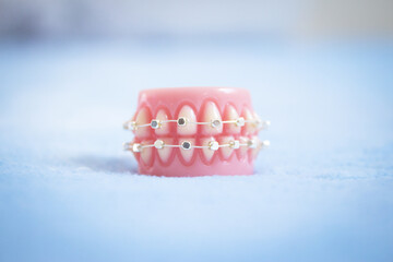 Metal orthodontic denture base