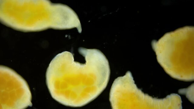 Worms Dinophilus taeniatus under a microscope, family Dinophilidae. Sample found in the White Sea, Jule.