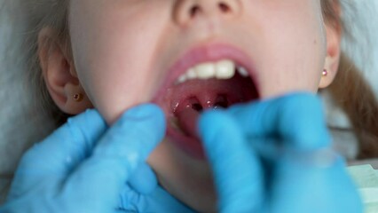 Dentist examining the child teeth, close-up