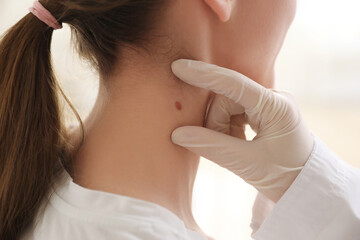 Dermatologist examining mole on young woman's neck in clinic, closeup