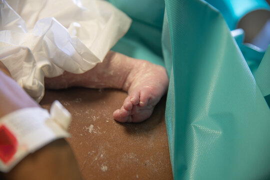 Close-up of newborn's foot with hospital wristband