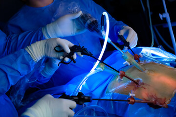 A team of surgeons performs laparoscopic surgery in the operating room using neon lights to illuminate the patient's abdomen. Minimally invasive surgery. Selective focus.