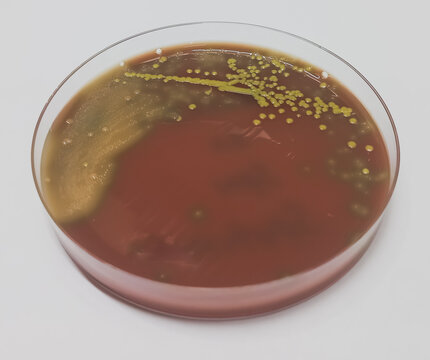 Golden color colonies on chocolate agar medium, growth of staphylococcus aureus, gram positive bacteria at medical microbiology laboratory. Golden staph.