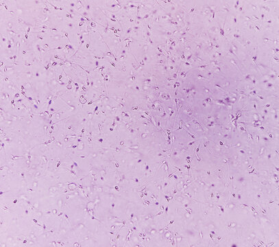 Semen analysis. Normozoospermia analyzed by microscope. Normal sperm count and morphology. 400x zoom image.
