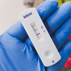 Adenovirus positive test result by using rapid test device. Rapid test kit.