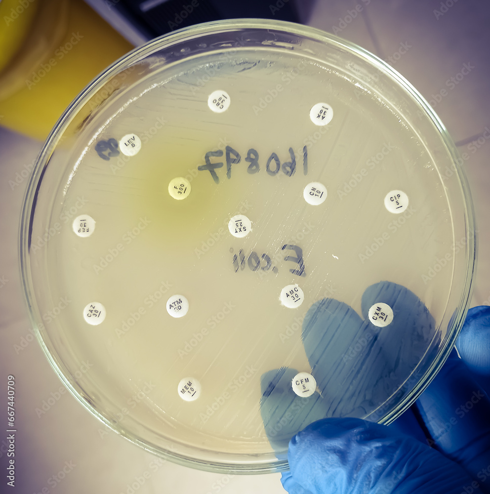 Wall mural All antibiotic are resistance. Antimicrobial susceptibility testing in culture plate. Drug sensitivity test, disk drug, antibiotic sensitivity.