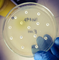 All antibiotic are resistance. Antimicrobial susceptibility testing in culture plate. Drug...