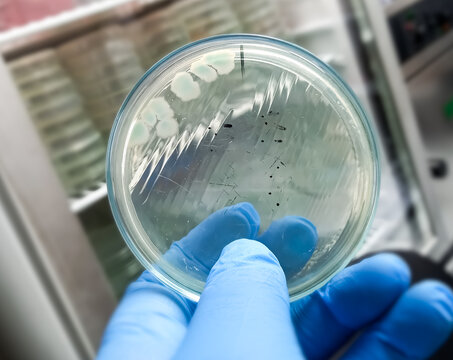 Culture of Penicillium spp. fungus on Sabouraud Dextrose Agar (SDA). Malt Extract Agar media in Petri dish use for cultivate yeast, black molds and fungi clinical test.