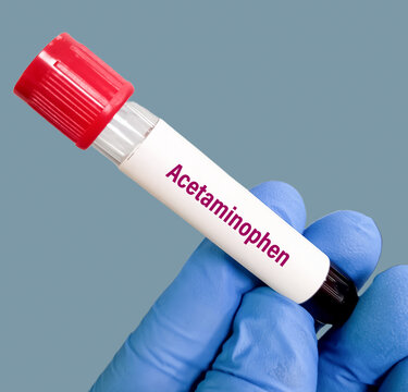 Scientist hold blood sample for Acetaminophen test. diagnosis of acetaminophen toxicity. paracetamol.