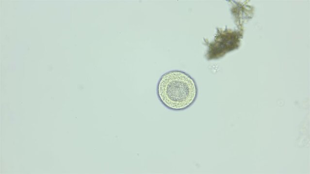 Larva sea urchin Strongylocentrotus pallidus under microscope, phylum Echinodermata. Blastula stage. White sea
