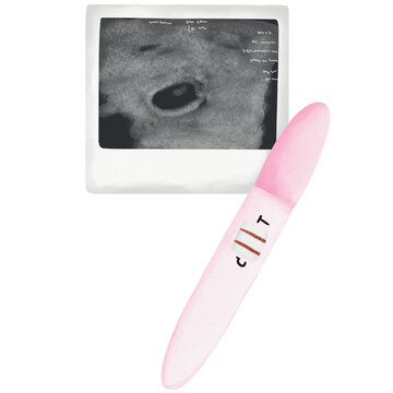 Pregnancy test. Ultrasound picture. Realistic pictures  on isolated white background 