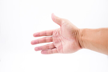 wrinkled or pruney hand because of soak in the water for a long time