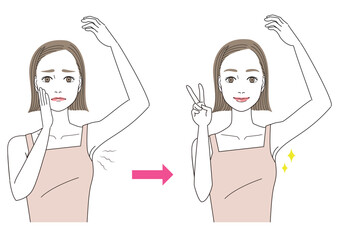 わきの臭い　わきがの治療ビフォアーアフター　女性のイラスト