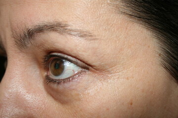 Blick, Auge einer Frau