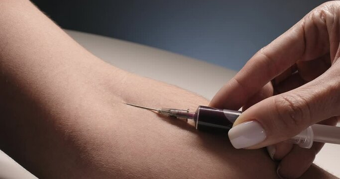Close-up of taking blood sample from vein. Blood analysis, laboratory examination of a sample of blood. Clinical research