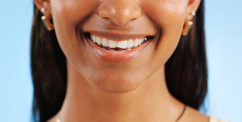 Teeth whitening, closeup of dental and woman with smile for oral care, wellness and mouth on blue...