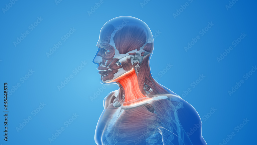 Wall mural platysma muscle pain and injury