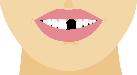 Mouth broken one toothless, illustration close-up