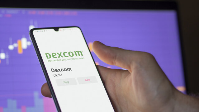 Logo of Dexcom on the screen of an exchange. Dexcom price stocks, $DXCM on a device.