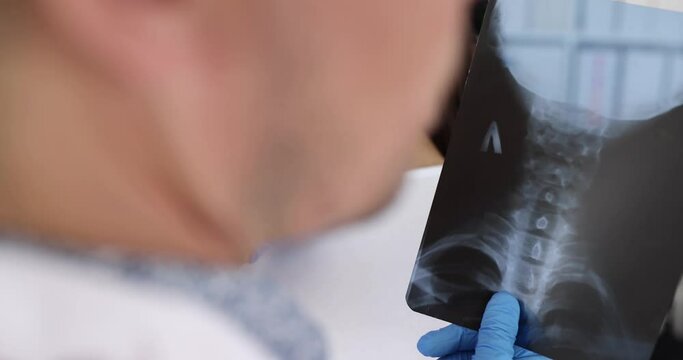 Doctor holds an X-ray image of cervical spine in hands and diagnoses patient neck. Treatment of osteochondrosis of cervical spine concept