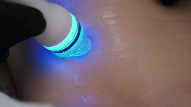 Non surgery cosmetology skincare. Vacuum cleaning and polishing neck skin of unrecognizable woman in cosmetology clinic. Professional moisturizing and rejuvenating hardware procedures