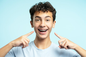 Portrait of overjoyed teenage boy showing  braces on teeth isolated on blue background. Dental,...