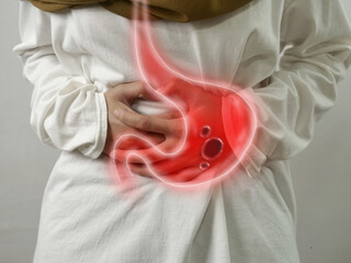 Digital composition of gastric ulcer on sick person, woman with stomach pain, health and medical