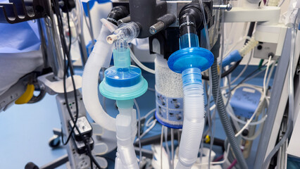 hospital's anesthesia machines, monitors, and airway equipment symbolize critical medical care, precision, and patient well-being in the operating room