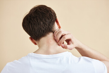 Fototapeta premium Back view of man scratching neck suffering from rash or skin condition, copy space