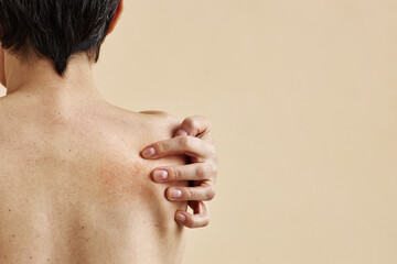 Close up of adult woman scratching bare back against minimal beige background with copy space