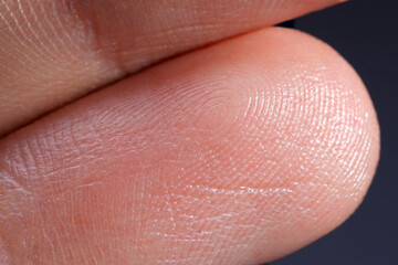 Macro view of finger with friction ridges