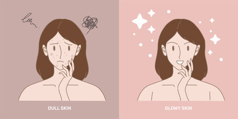 Face of woman with skin problem compare with healthy skin. Dull skin and glowy skin. Hand drawn flat cartoon character vector illustration.