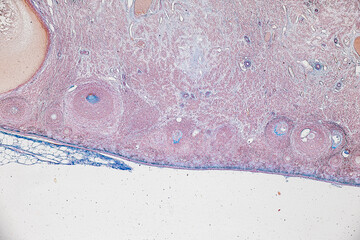 Backgrounds of Characteristics Tissue of Ovary rabbit and Tissue of Testis mouse under microscope.