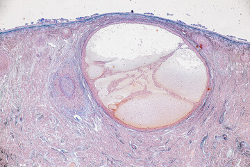 Backgrounds of Characteristics Tissue of Ovary rabbit and Tissue of Testis mouse under microscope.