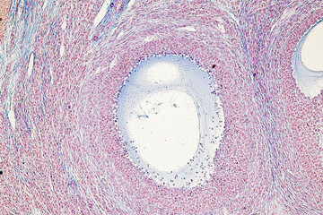 Backgrounds of Characteristics Tissue of Ovary rabbit and Tissue of Testis mouse under microscope.