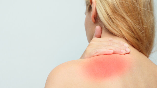 Woman putting hand on injured neck. Woman applying pain relief gel on her shoulder and neck