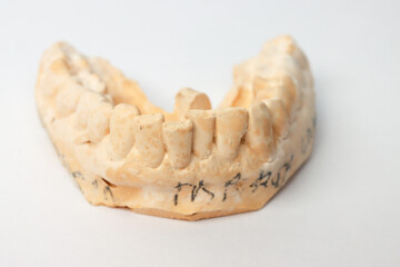 Close up of An impression or plaster mold of a man’s lower teeth