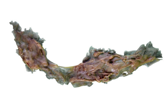 Element of plastic makeup for the face on a transparent background, scar, wound
