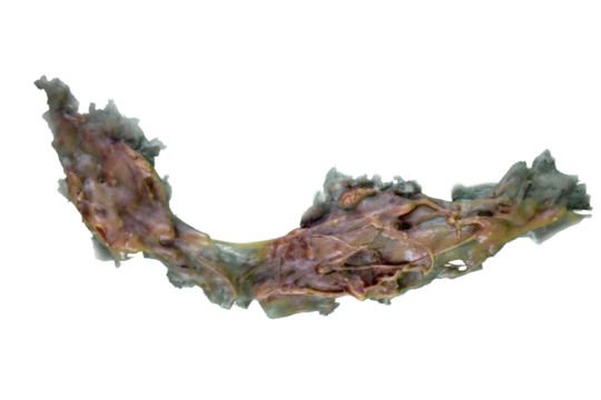 Element of plastic makeup for the face on a transparent background, scar, wound