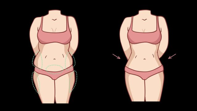 Female Body liposuction fitness slim body fat. fat body to slim body transformation. 4k cartoon animation